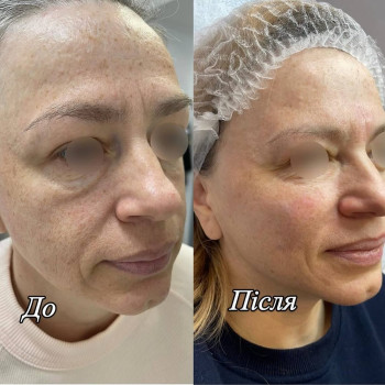 Фото с портфолио LA