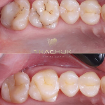 Фото с портфолио Тkachuk Dental