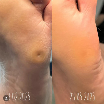 Фото с портфолио Podo Med