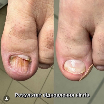 Фото с портфолио Podo Med