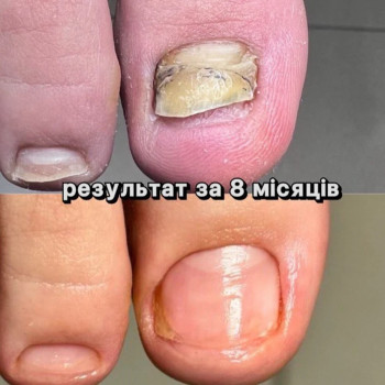 Фото с портфолио Podo Med