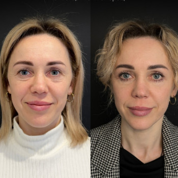 Фото с портфолио True Beauty