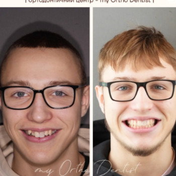 Фото с портфолио My Ortho Dentist