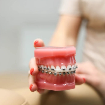 Фото с портфолио My Ortho Dentist