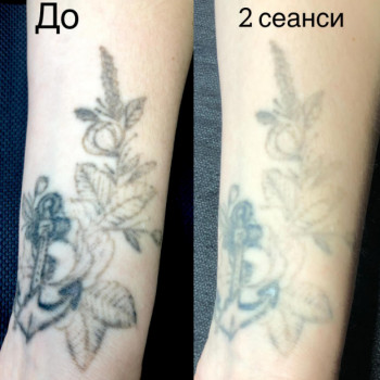 Фото с портфолио Олег Билан