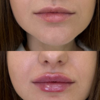 Фото с портфолио Анастасия Матяшок