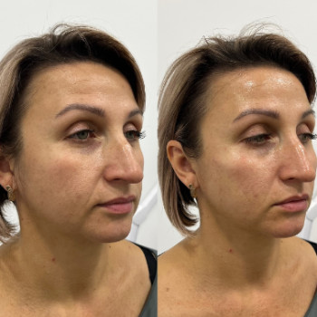 Фото с портфолио Анастасия Матяшок