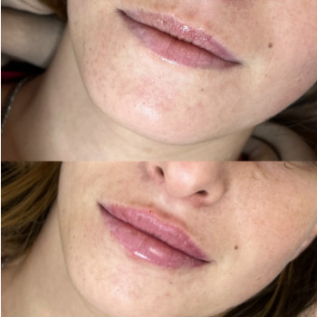 Фото с портфолио Анастасия Матяшок