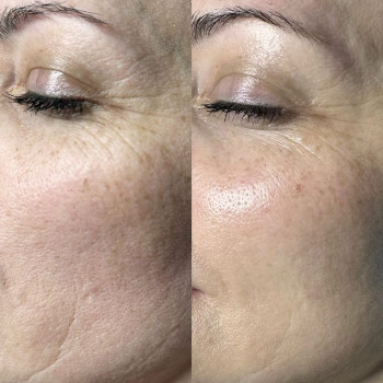 Фото с портфолио Леся Городинська