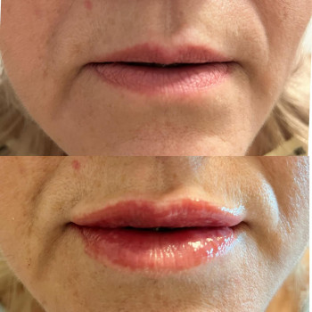 Фото с портфолио Леся Городинська