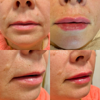 Фото с портфолио Леся Городинська