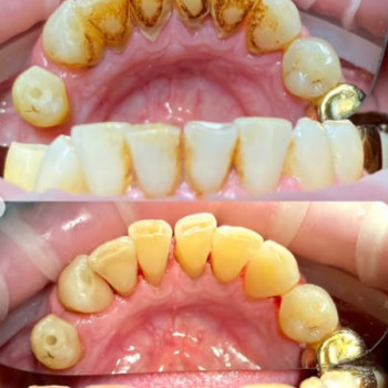 Фото с портфолио Smile