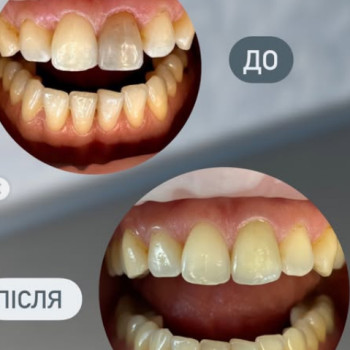 Фото с портфолио Smile