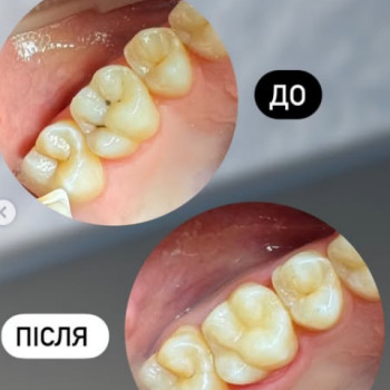 Фото с портфолио Smile