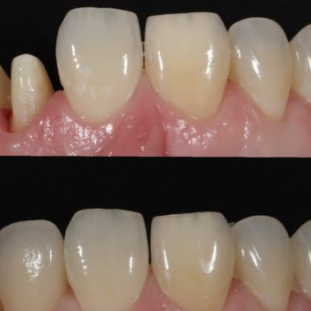 Фото с портфолио Smile