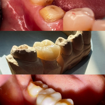 Фото с портфолио Стоматологія Asteria