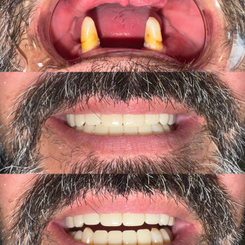 Фото с портфолио Стоматологія Asteria