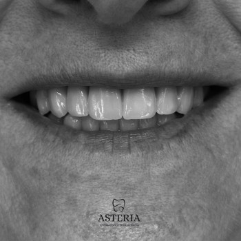 Фото с портфолио Стоматологія Asteria