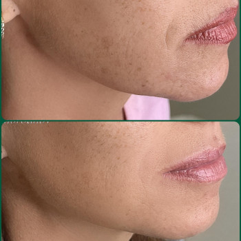 Фото с портфолио Творці Краси