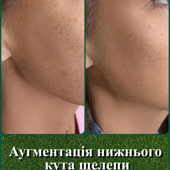 Фото с портфолио Творці Краси