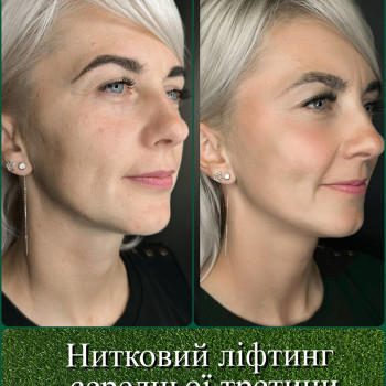 Фото с портфолио Творці Краси