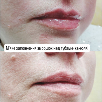 Фото с портфолио Ирина Родимченко