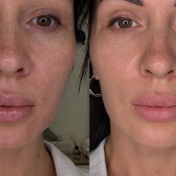 Фото с портфолио Марина Чеховська