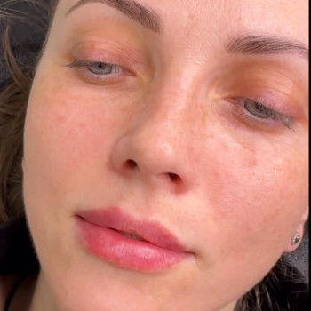 Фото с портфолио Марина Чеховська