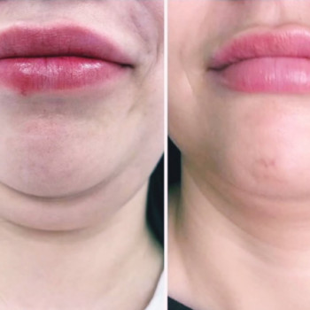 Фото с портфолио Надія Маліневська