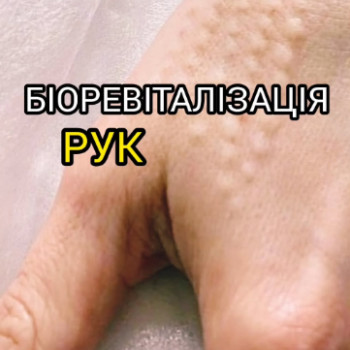 Фото с портфолио Надія Маліневська