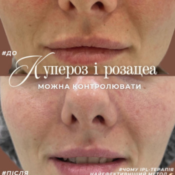 Фото с портфолио Krasa