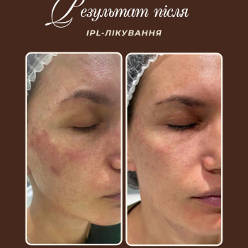 Фото с портфолио Krasa