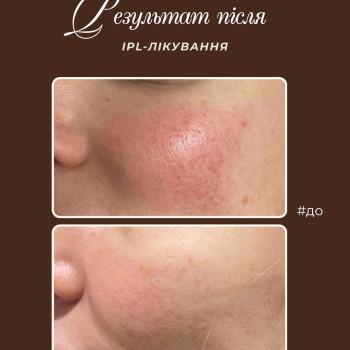 Фото с портфолио Krasa