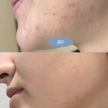 Фото с портфолио Krasota