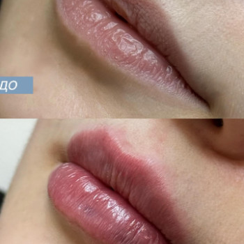 Фото с портфолио Krasota