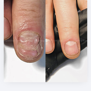 Фото с портфолио Катерина Олександрівна Олійник