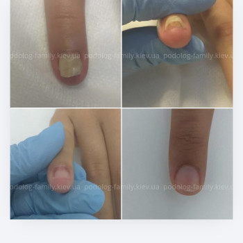 Фото с портфолио Катерина Олександрівна Олійник