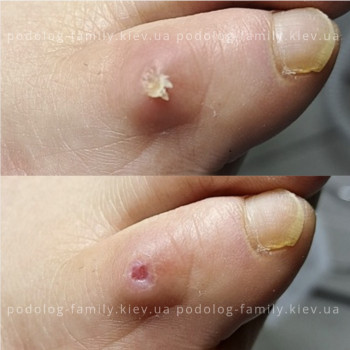 Фото с портфолио Катерина Олександрівна Олійник