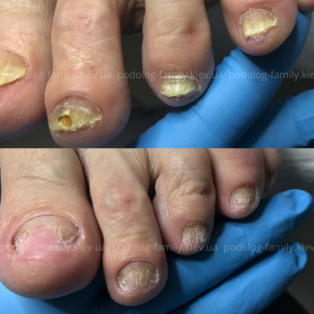 Фото с портфолио Катерина Олександрівна Олійник