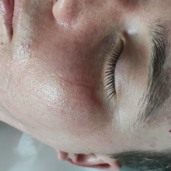 Массаж лица