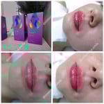 Акція - 30% "Губи твоєї мрії"! Косметолог Анна Вінниця