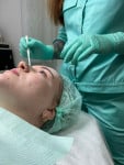 Чистка обличчя – 14% (у подарунок процедуру "Зволоження - Маска + сировотка") Косметолог Анна Вінниця