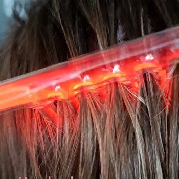 Процедура: дарсонвалізація волосистої частини голови. Стимуляція росту волосся, себорегуляція, оздоровлення шкіри.