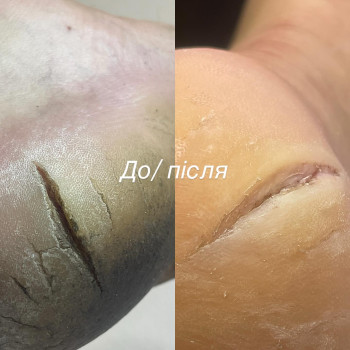 Фото с портфолио Владислава Демідко