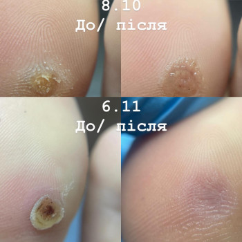 Фото с портфолио Владислава Демідко