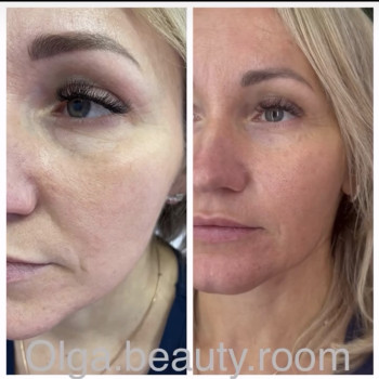 Фото с портфолио Ольга Мельник