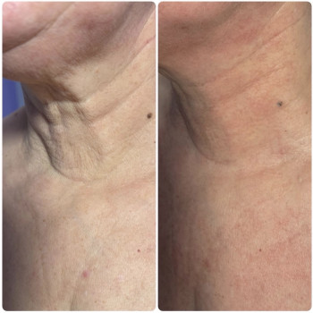 Фото с портфолио Оля Мельник