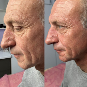 Фото с портфолио Оля Мельник