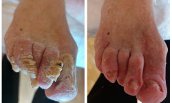 Виїзд додому до літніх та хворих Подолог Ірина Київ