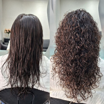 Озонотерапія